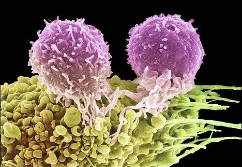 раковые клетки